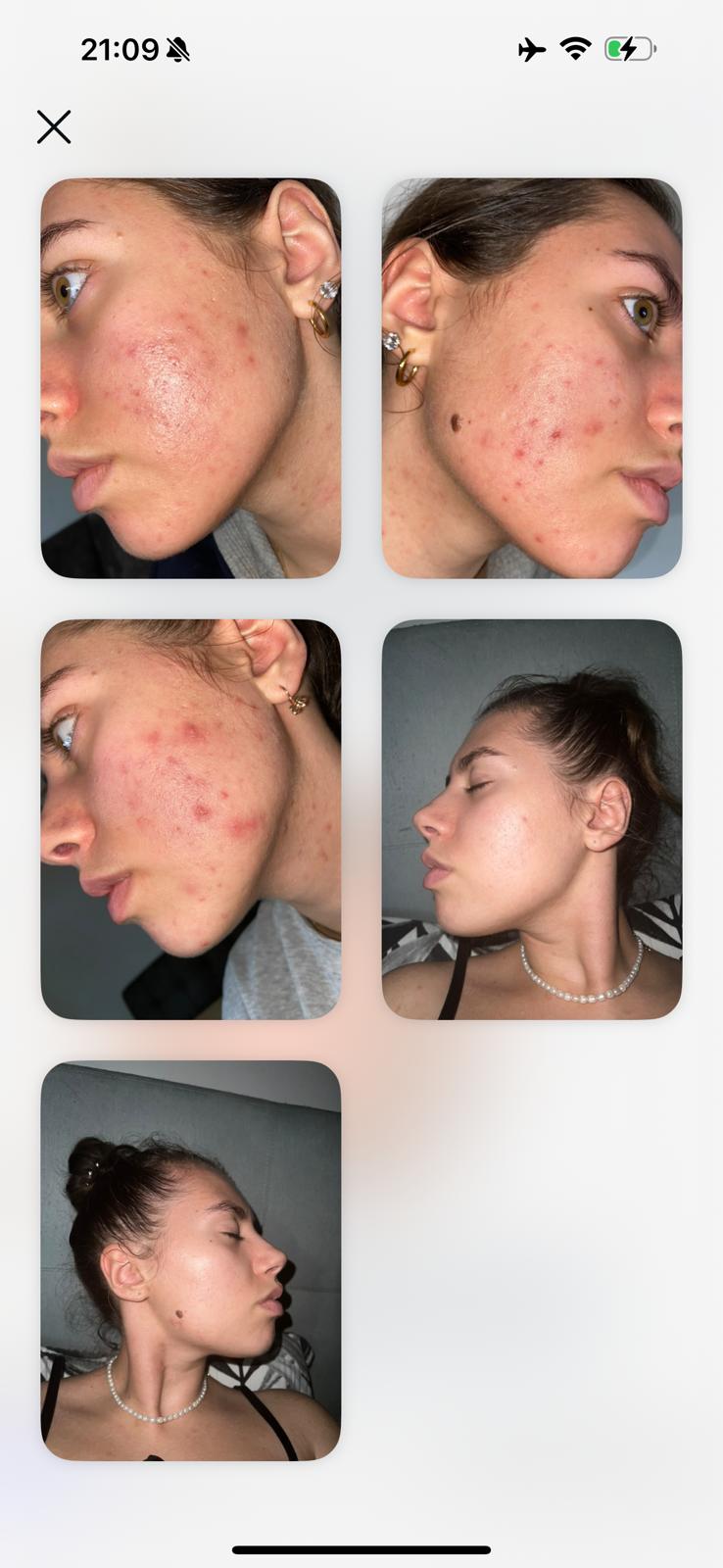 Nadja — Haut-Transformation Collage